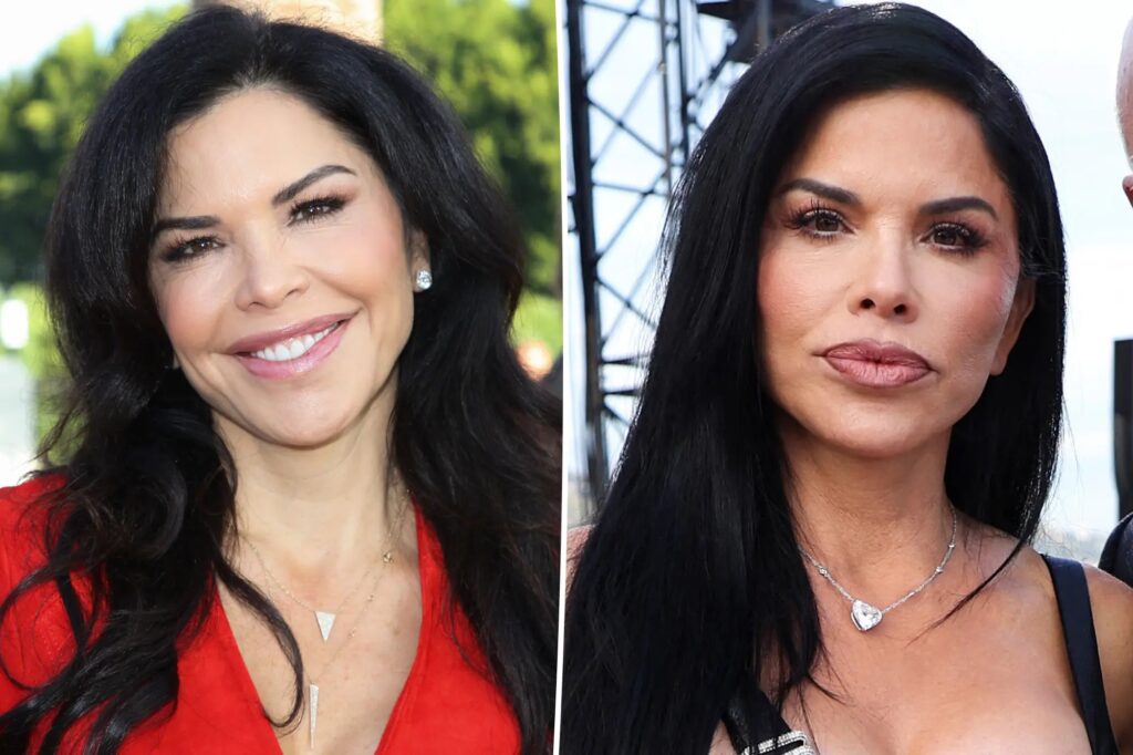 lauren sanchez plastic surgery before and after